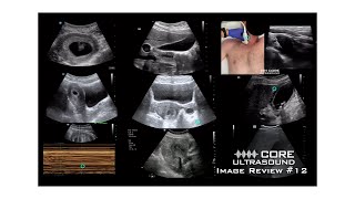 Core Ultrasound Image Review 12 [upl. by Deroo642]