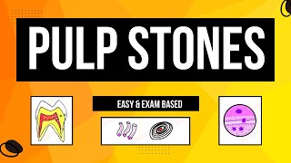 Denticles  Pulp Stones Classification  Age change in pulp [upl. by Liris297]