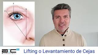 Lifting o Levantamiento de Cejas [upl. by Hutson376]