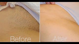 Brazilian Waxing 101 All You Need To knowTips [upl. by Nelaf]