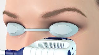 E EYE  Operating mechanism of Dry Eye treatment  EN [upl. by Aleunamme984]