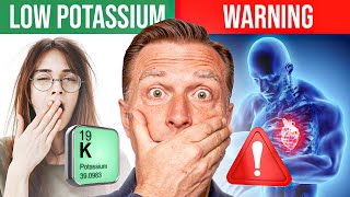 The POTASSIUM Epidemic Dr Berg Explains Symptoms Signs Diet Causes and Treatment [upl. by Alyel]