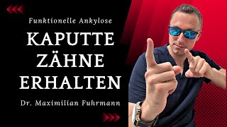 Stark zerstörte Zähne erhalten Wie Mit funktioneller Ankylose  Zahnarzt Dr Maximilian Fuhrmann [upl. by Montano]