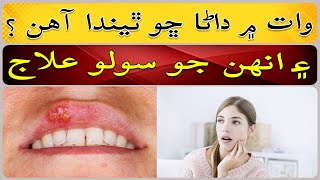 Why are there herpetic stomatitis in the mouth [upl. by Enyaht]