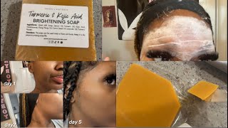 Turmeric amp Kojic Acid Soap From TikTok [upl. by Kronfeld]