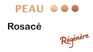 Peau  Rosacé [upl. by Edorej]