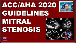 ACC AHA Guidelines 2020  Mitral Stenosis  Diagnosis and Management  Dr Nik Nikam [upl. by Gastineau]