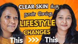 Acne to clear skin journey  This lifestyle changes for clear glowing Skin ✨️ acne acnetreatment [upl. by Elleinwad554]