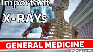 XRAY of General Medicine DRAKD [upl. by Nivrem]