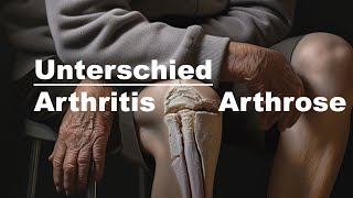 Arthrose und Arthritis  Unterschied [upl. by Humfried]