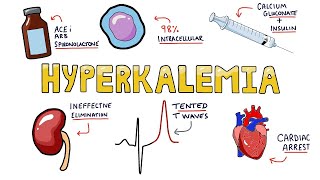 Hyperkalemia  Causes Symptoms Diagnosis and Treatment in Less Than 5 Minutes [upl. by Barbee]