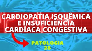 CARDIOPATIA ISQUÊMICA E INSUFICIÊNCIA CARDÍACA CONGESTIVA  PATOLOGIA 28 [upl. by Tarrance]