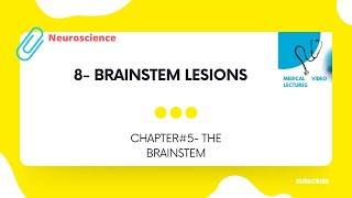 Brainstem lesions  CHAPTER5 THE BRAINSTEM [upl. by Evania]