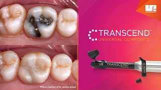 Transcend Universal Composite [upl. by Nnyllatsyrc]