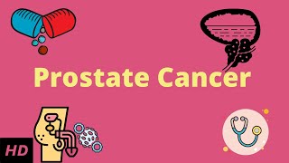 Prostrate Cancer Causes Signs and Symptoms DIagnosis and Treatment [upl. by Pierpont]