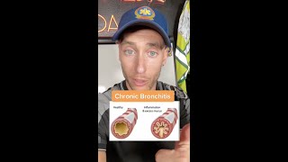 Chronic Bronchitis vs Emphysema  EMTParamedic  The Paramedic Coach Shorts [upl. by Rosalie521]