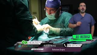 Buccal Fat Pad Removal Procedure Bichectomy Surgery [upl. by Einner363]