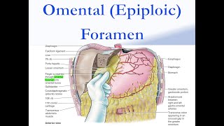 Omental Epiploic Foramen [upl. by Asylem]