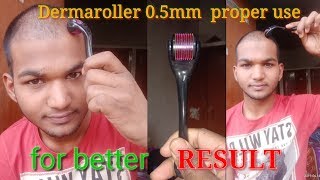 How to use derma roller system 05mm proper for better result।Sonu Kumar Mishra। dermarollersystem [upl. by Roehm]