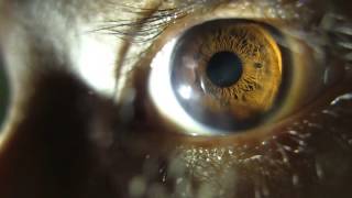 Pupil Dilating eye changing apeture HD [upl. by Kadner445]