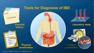 Diagnosing IBD [upl. by Odarbil297]