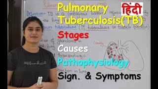 Pulmonary Tuberculosis in Hindi  Stages  Causes  Pathophysiology  Sign amp Symptoms [upl. by Nels]