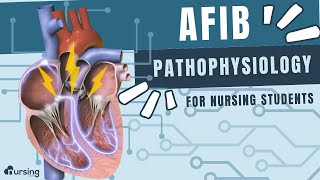 AFIB Atrial Fibrillation Pathophysiology Cardiac Nursing [upl. by Giwdul251]