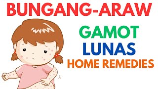 Ano ang mabisang lunas sa bungang araw  Pinoy MD [upl. by Nivrac]