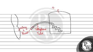 Write notes on Artificial kidney \ \mathrmW \ [upl. by Eadahs273]