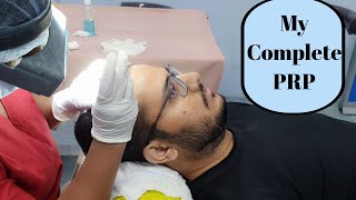 My full PRP session at Eugenix Hair Sciences  Second PRP after 21 months of Hair Transplant [upl. by Bethena]