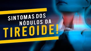 Tratamento de nódulos tóxicos da tireoide o que você precisa saber [upl. by Shum706]