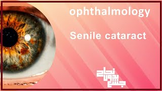 L2021 senile cataract lens disorders opthalmology [upl. by Ddal297]