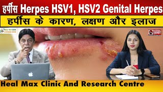 हर्पीस Herpes HSV 1 HSV 2 Genital Herpes का सफल इलाज  Dr Raghav  Heal Max Clinic National Khabar [upl. by Harvard]