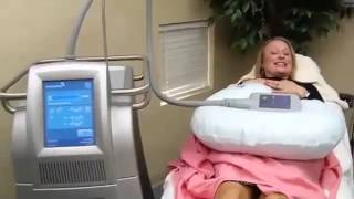 A Demonstration of CoolSculpt with Dr Jennifer Pennoyer [upl. by Allwein]