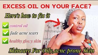 SKINCARE ROUTINE FOR OILY ACNEPRONE SKIN A Routine for a healthy glowing skin [upl. by Suillenroc]