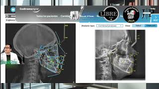 Ceph assistant para cefalometría con IA de cedirama [upl. by Rabush]