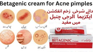 Cream Betagenic Uses And Price In PakistanShahid Madicine Info [upl. by Rehpotsihc420]