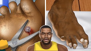 ASMR Animation Pulling nails out of Lebron Jamess soles  WOW Brain Satisfying Toenail [upl. by Stauffer367]