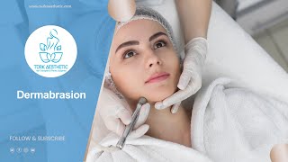 Dermabrasion in Turkey 45 Minutes  Turk Aesthetic [upl. by Konrad824]