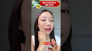 Complete dark spots skin treatment with Renewal Face Cream darkspots darkspotsonface [upl. by Bilak806]