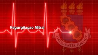 Semiologia do Sistema Cardiovascular Parte 14 PET Medicina UFC Sobral [upl. by Schroeder]