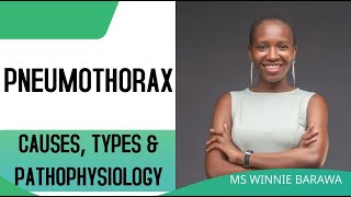 PNEUMOTHORAX TYPES  TENSION OPEN CLOSED PNEUMOTHORAX PATHOPHYSIOLOGY CAUSES [upl. by Ornstead]