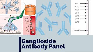 Ganglioside antibody panel  Anti GM1  Immune mediated neuropathy  MMN  MADSAM  CIDP  GBS [upl. by Vittoria]