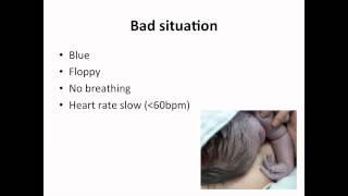 Paediatrics  neonatal resuscitation [upl. by Elison562]