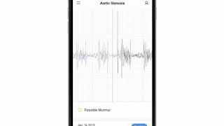 Aortic Stenosis Phonocardiogram  EkoCLINIC App [upl. by Ellenrahc]