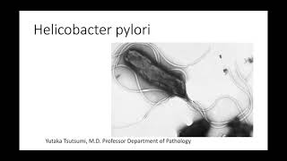 Batteriologia  lezione 22 Helicobacter pylori [upl. by Shull]