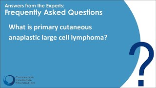 Rare Variant Primary Cutaneous Anaplastic Large Cell Lymphoma [upl. by Enyledam174]