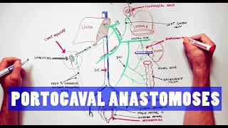 Portocaval Anastomoses  ANATOMY Tutorial [upl. by Keelin204]