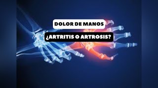 CÓMO TRATAR ARTRITIS Y ARTROSIS DE MANOS [upl. by Enened83]