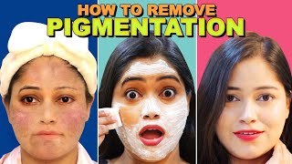 How to remove Pigmentation Naturally😯कितने भी गहरे दाग धब्बे हो सब गायब Remove Dark spots Acnes [upl. by Bertina]